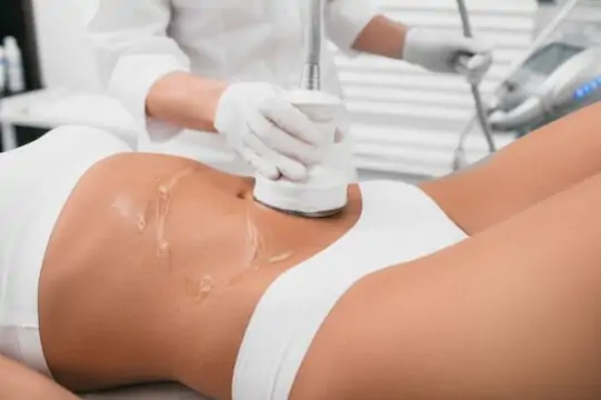 Does Liposuction Leave Scars